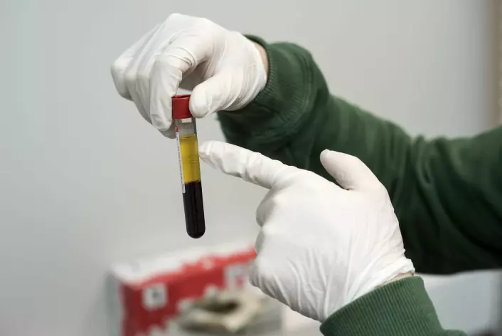 Blodserum trekkes ut med pipette og lagres i en egen biobank. (Foto: Lars Teppan Johansen)
