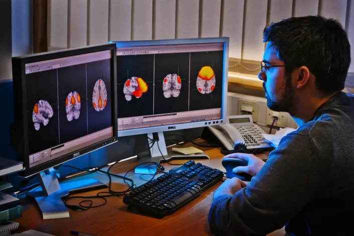 Forsker arbeider med hjernebilder skannet med funksjonell magnetresonans (fMRI) på venstre skjerm og magnetoencephalografi (MEG) på høyre skjerm. Begge bilder viser hjernen i hviletilstand. (Foto: Science Photo Library)