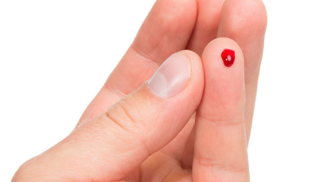 Den nye teknologien gjør det mulig å lage nye blodårer mye raskere enn tidligere. (Illustrasjonsfoto: Microstock) Den nye teknologien gjør det mulig å lage nye blodårer mye raskere enn tidligere. (Illustrasjonsfoto: Microstock)