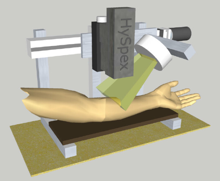 Skader og sår ble skannet med et Hyspex hyperspektralt kamera fra Norsk Elektro Optikk. (Foto: (Bilde: Norsk Elektro Optikk/Martin Denstedt et.al: Hyperspectral imaging as a diagnostic tool for chronic skin ulcers, Photonic Therapeutics and Diagnostics IX, Proc. of SPIE Vol. 8565, 2013)) Skader og sår ble skannet med et Hyspex hyperspektralt kamera fra Norsk Elektro Optikk. (Foto: (Bilde: Norsk Elektro Optikk/Martin Denstedt et.al: Hyperspectral imaging as a diagnostic tool for chronic skin ulcers, Photonic Therapeutics and Diagnostics IX, Proc. of SPIE Vol. 8565, 2013))