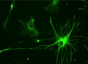 I musenes hjerner utviklet de menneskelige gliacellene seg til astrocytter, som overtok plassen til musenes egne celler.  (Illustrasjonsfoto: Bruno Pascal, Wikimedia Commons)