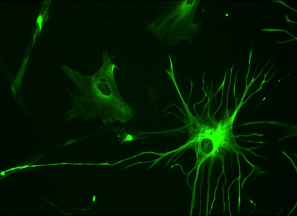 I musenes hjerner utviklet de menneskelige gliacellene seg til astrocytter, som overtok plassen til musenes egne celler.  (Illustrasjonsfoto: Bruno Pascal, Wikimedia Commons)