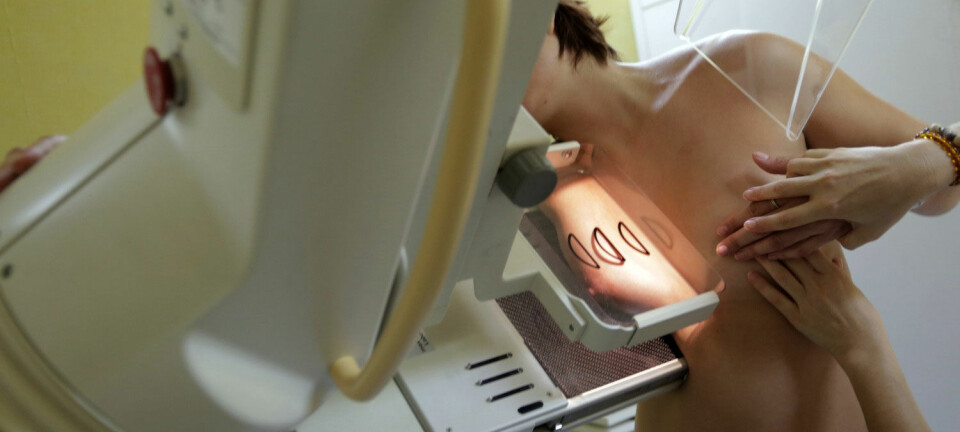 Brystkreft er den mest utbredte kreftformen blant kvinner. Rundt 3000 kvinner rammes av denne sykdommen årlig i Norge. (Foto: Reuters)