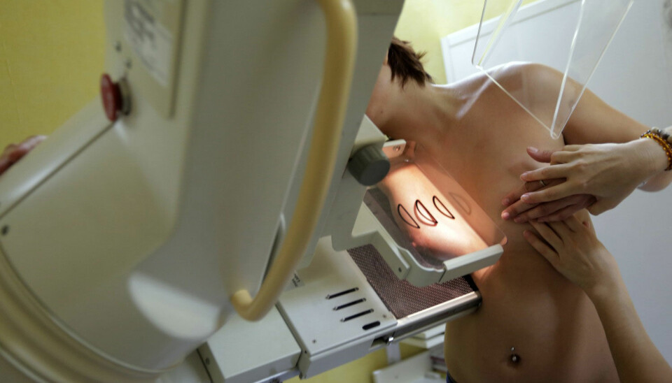 Brystkreft er den mest utbredte kreftformen blant kvinner. Rundt 3000 kvinner rammes av denne sykdommen årlig i Norge. (Foto: Reuters)
