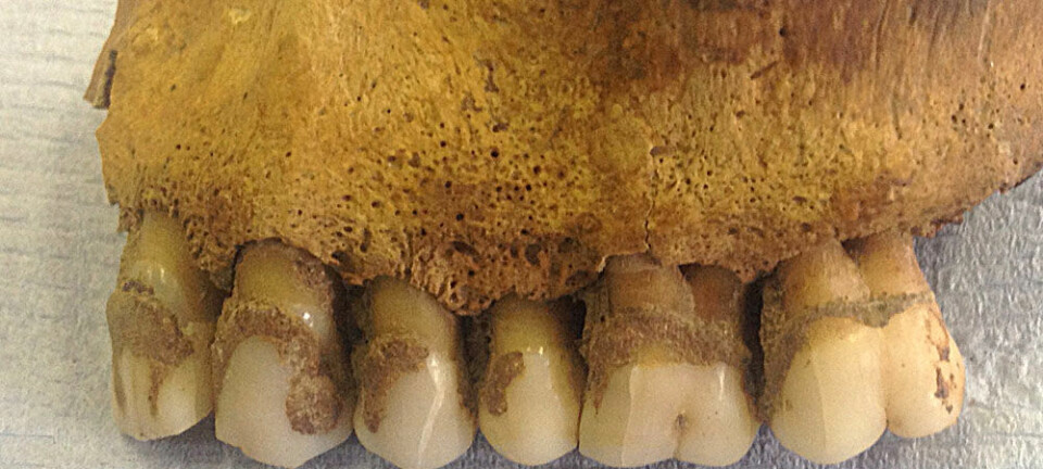 Forskerne fant myseproteiner i tannsteinen på gamle skjeletter.  (Foto: Sarah Fiddyment)