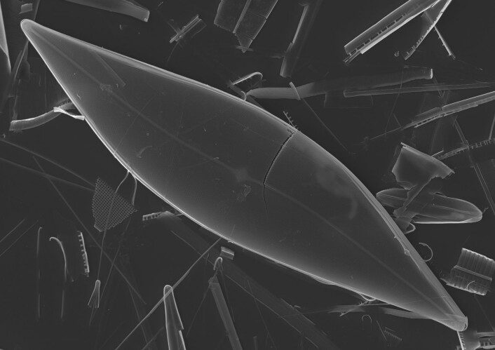 Her er et mikroskopbilde av sjøis-diatomer (<em>Pleurosigma stuxbergii</em>), som produser den organiske biomarkøren som forskerne gransker i arbeidet med å beskrive havisutbredelsen i Arktis. (Foto: Thomas A. Brown, Simon T. Belt) Her er et mikroskopbilde av sjøis-diatomer (<em>Pleurosigma stuxbergii</em>), som produser den organiske biomarkøren som forskerne gransker i arbeidet med å beskrive havisutbredelsen i Arktis. (Foto: Thomas A. Brown, Simon T. Belt)