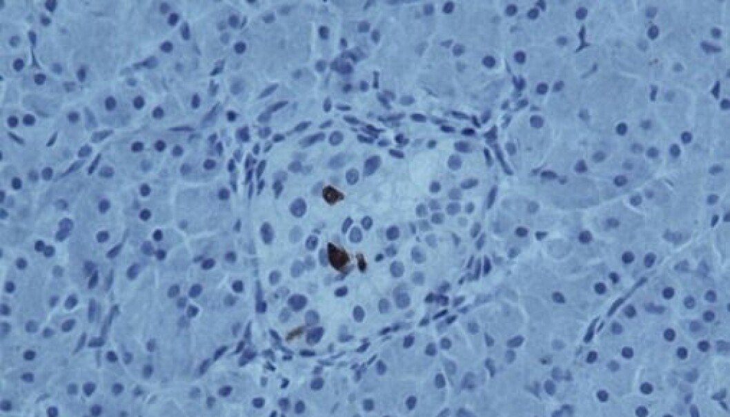 De mørke feltene er påviste spor av virus i insulinproduserende celler. (Foto: DiViD) De mørke feltene er påviste spor av virus i insulinproduserende celler. (Foto: DiViD)