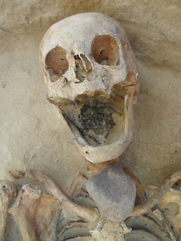 En annen kvinne på rundt 45-49 år, ble gravlagt med en stein på strupen. (Foto: Gregoricka et al.) En annen kvinne på rundt 45-49 år, ble gravlagt med en stein på strupen. (Foto: Gregoricka et al.)