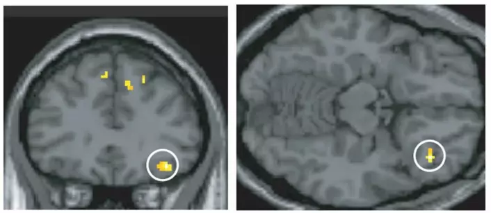 To regioner av hjernen ble aktivert i eksperimentet; fremre delen av tinninglappen og frontallappens underside. Dette er områder som allerede er kjent for å bringe sammen ulike sanser. Over er frontallappen. (Foto: Jonas Olofsson/Stockholm universitet)