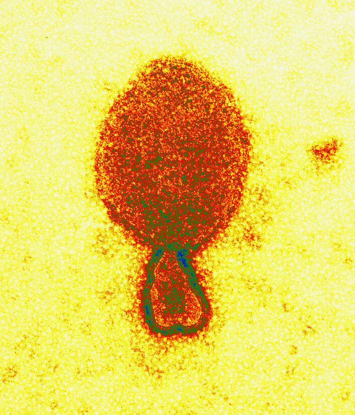 Hendravirus under elektronmikroskop. (Foto: Electron Microscopy Unit AAHL, CSIRO)