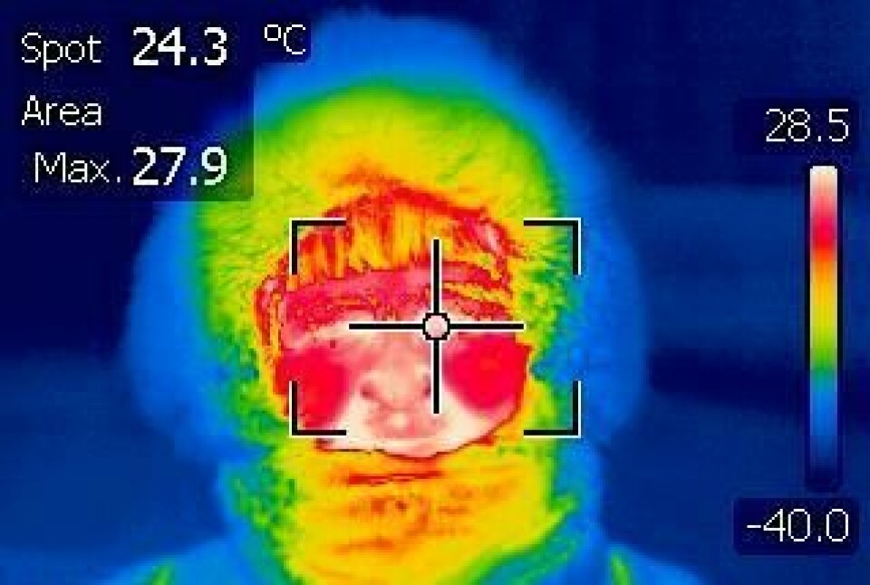 I -40 grader i Karasjok holder øyet høyere temperatur enn andre deler av ansiktet. På bildet tatt med infrarødt kamera er de varmeste områdene markert med hvitt. Det er øynene og området rundt munnen. (Foto: Jon Klokk Slettedal)