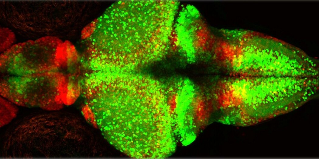 Forskere studerte epilepsianfall hos sebrafisk. Fisken er gjennomsiktig og de kan observere aktiviteten i nervesystemet. (Foto: Yaksi Lab, NTNU) Forskere studerte epilepsianfall hos sebrafisk. Fisken er gjennomsiktig og de kan observere aktiviteten i nervesystemet. (Foto: Yaksi Lab, NTNU)