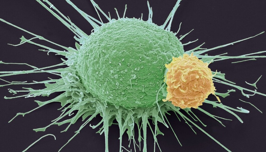 null (Foto: Scanpix/Science Photo Library) null (Foto: Scanpix/Science Photo Library)