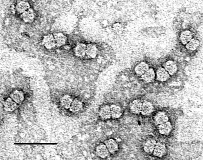 Illustrasjonsbilde av moderne geminivirus. (Foto: Ed Rybicki/Public domain) Illustrasjonsbilde av moderne geminivirus. (Foto: Ed Rybicki/Public domain)