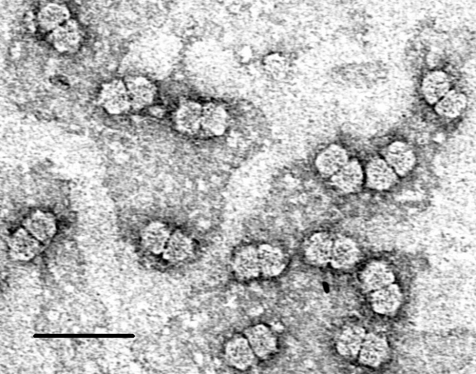 Illustrasjonsbilde av moderne geminivirus.  (Foto: Ed Rybicki/Public domain)
