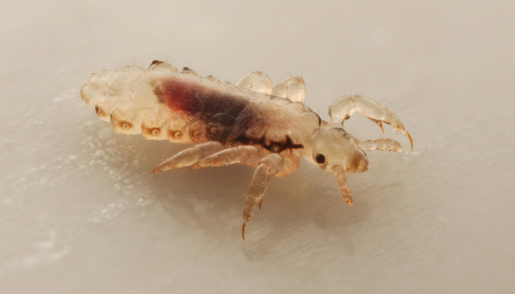 Hodelus lever bare på mennesker, den snylter på blodet vårt og lever tett til hodebunnen. (Foto: devil79sd / Shutterstock / NTB scanpix) Hodelus lever bare på mennesker, den snylter på blodet vårt og lever tett til hodebunnen. (Foto: devil79sd / Shutterstock / NTB scanpix)