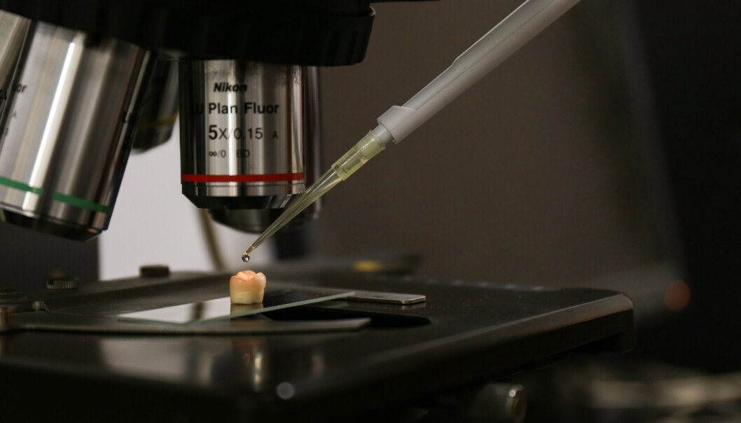 Her dryppes en kalsiumfosfatløsning på en tann for å bygge opp bortetset tannemalje. Foto: Zhejiang University / Science Advances Her dryppes en kalsiumfosfatløsning på en tann for å bygge opp bortetset tannemalje. Foto: Zhejiang University / Science Advances