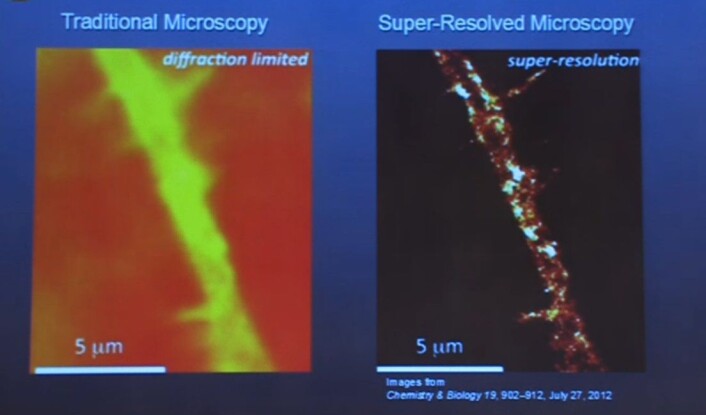 Bildet viser hvor mye klarere mikroskopiske bilder blir av de nye teknikkene. Bildet til høyre er tatt gjennom et fluorescensmikroskop. (Foto: Skjermdump) Bildet viser hvor mye klarere mikroskopiske bilder blir av de nye teknikkene. Bildet til høyre er tatt gjennom et fluorescensmikroskop. (Foto: Skjermdump)