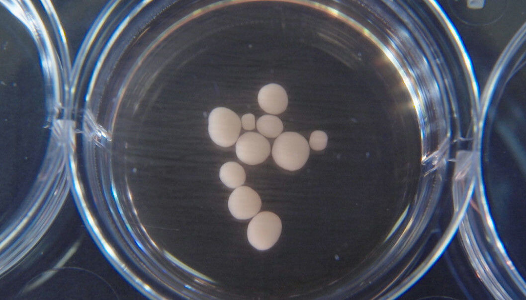 Dette er mini-hjerner som forskere har dyrket. Men hvor mye ligner de på ekte hjerner? (Foto: Muotri Lab/UCTV) Dette er mini-hjerner som forskere har dyrket. Men hvor mye ligner de på ekte hjerner? (Foto: Muotri Lab/UCTV)