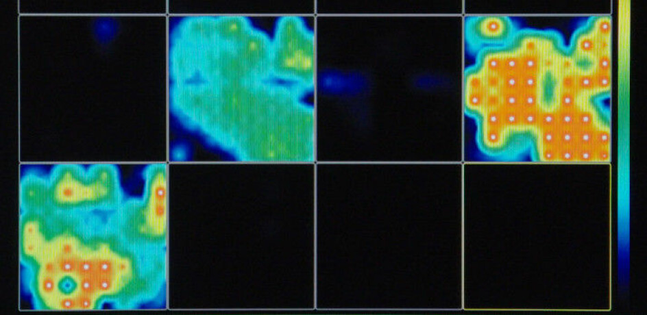 Forskerne fulgte med på den elektriske aktiviteten i minihjernene. Jo rødere farge, jo mer aktivitet. Svart farge betyr null aktivitet. (Foto: Muotri Lab/UCTV)