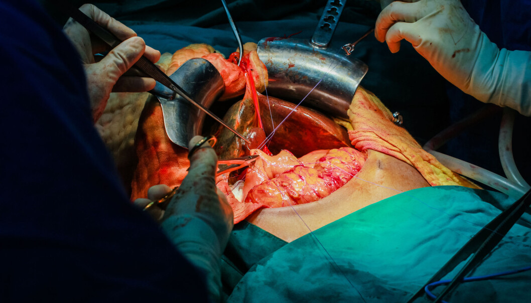 Ny metode kan holde lenger liv i en lever som skal transplanteres, fra dagens tolv timer til over et og et halvt døgn. (Foto: Shutterstock) Ny metode kan holde lenger liv i en lever som skal transplanteres, fra dagens tolv timer til over et og et halvt døgn. (Foto: Shutterstock)