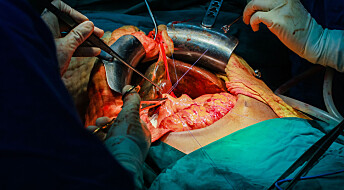 Superkjøling av organer kan øke antall transplantasjoner