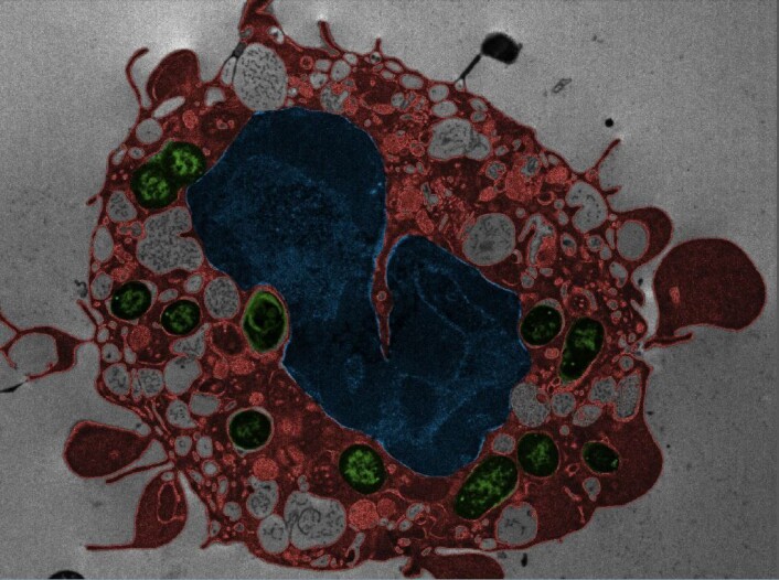 En immuncelle er i ferd med å dø etter Yersinia pestis-infeksjon. Cellmembranen får blæredanning og cellekjernen endrer seg. Grønt: bakterier. Rødt: celleinnhold. Blått: Cellekjerne. (Foto: NTNU) En immuncelle er i ferd med å dø etter Yersinia pestis-infeksjon. Cellmembranen får blæredanning og cellekjernen endrer seg. Grønt: bakterier. Rødt: celleinnhold. Blått: Cellekjerne. (Foto: NTNU)