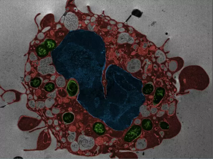En immuncelle er i ferd med å dø etter Yersinia pestis-infeksjon. Cellmembranen får blæredanning og cellekjernen endrer seg. Grønt: bakterier. Rødt: celleinnhold. Blått: Cellekjerne.  (Foto: NTNU)
