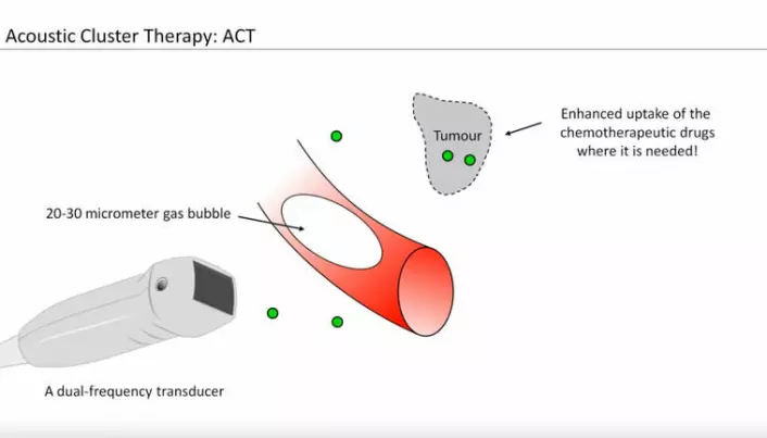 To-frekvent ultralyd manipulerer mikrobobler for å øke opptaket av cellegift til en kreftsvulst. (Illustrasjon fra presentasjon som viser metoden til Kenneth Kirkeng Andersen)