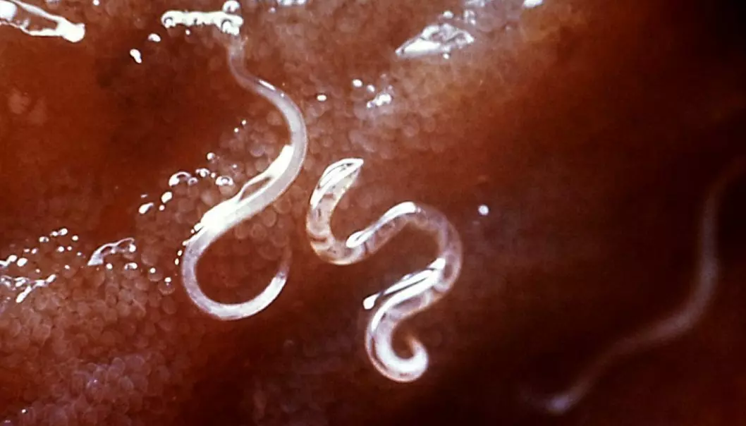 Hakeormen fester seg i tarmen og suger til seg næring.  (Foto: Wikimedia commons/Centers for disease control and prevetion)