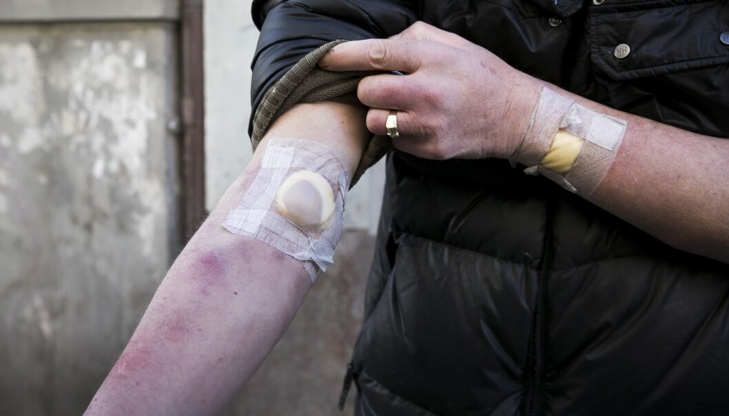 – Det er langt flere som dør av overdose i Norge enn av trafikkulykker. Rusmisbrukere fortjener nye medisiner, i likhet med andre pasientgrupper, mener Arne Skulberg, anestesilege og doktorgradsstipendiat ved NTNU. (Foto: Scanpix, Heiko Junge) – Det er langt flere som dør av overdose i Norge enn av trafikkulykker. Rusmisbrukere fortjener nye medisiner, i likhet med andre pasientgrupper, mener Arne Skulberg, anestesilege og doktorgradsstipendiat ved NTNU. (Foto: Scanpix, Heiko Junge)