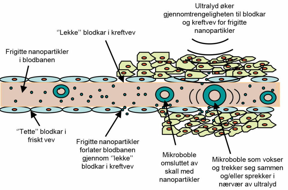 Illustrasjonen viser hvordan ultralydbehandlingen virker på blodkar i kreftvev.  (Foto: (Illustrasjon: Siv Eggen, NTNU))