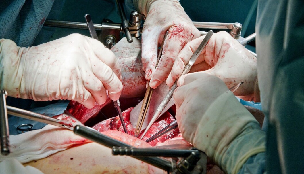 – En lever fra en eldre donor er nok ikke like bra som en lever fra en 20-åring. Men i en situasjon med mangel på organer må vi fokusere på hva som er godt nok, sier Thorsen.
(Foto: Ram Gupta) – En lever fra en eldre donor er nok ikke like bra som en lever fra en 20-åring. Men i en situasjon med mangel på organer må vi fokusere på hva som er godt nok, sier Thorsen.
(Foto: Ram Gupta)
