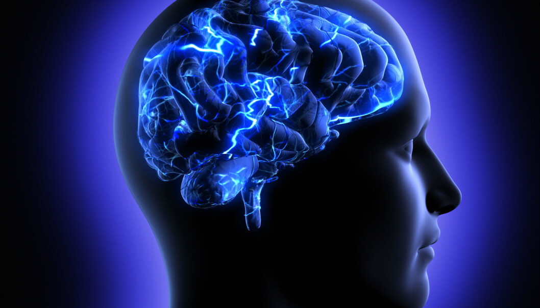 Forskere fra hele verden kritiserer hjerneforskningsprosjektet Human Brain Project for å ha en for snever tilnærming. (Foto: Microstock) Forskere fra hele verden kritiserer hjerneforskningsprosjektet Human Brain Project for å ha en for snever tilnærming. (Foto: Microstock)