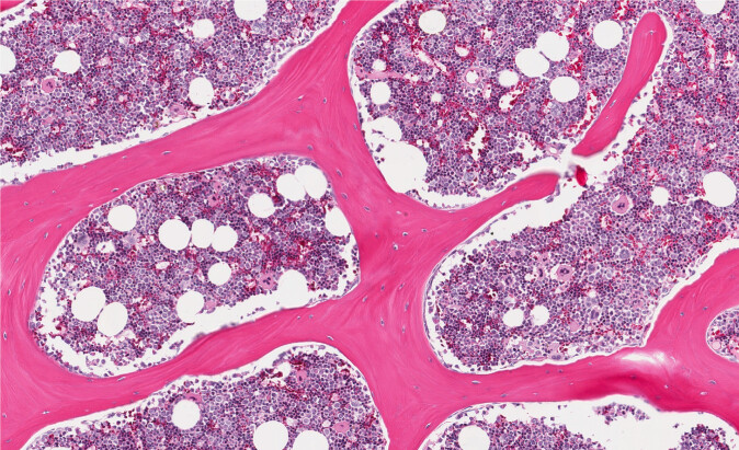 Ifølge Gerard Karsenty blir det ofte oversett at skjelettet er et såkalt endokrint organ, noe som vil si at det sender beskjeder til andre organer gjennom hormoner. Her ser vi celler i benmarg hos et menneske. (Foto: vetpathologist / Shutterstock / NTB scanpix) Ifølge Gerard Karsenty blir det ofte oversett at skjelettet er et såkalt endokrint organ, noe som vil si at det sender beskjeder til andre organer gjennom hormoner. Her ser vi celler i benmarg hos et menneske. (Foto: vetpathologist / Shutterstock / NTB scanpix)