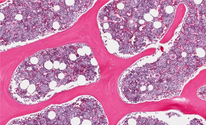 Ifølge Gerard Karsenty blir det ofte oversett at skjelettet er et såkalt endokrint organ, noe som vil si at det sender beskjeder til andre organer gjennom hormoner. Her ser vi celler i benmarg hos et menneske. (Foto: vetpathologist / Shutterstock / NTB scanpix)