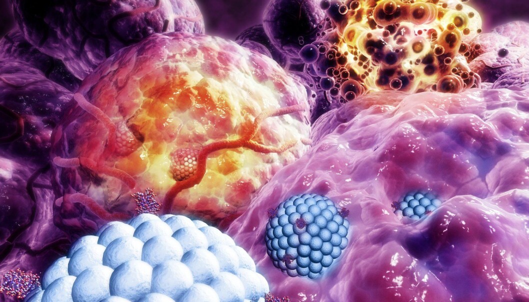 Illustrasjonen viser nanopartikler (blå) som ødelegger kreftcelle (lilla). De ødelagte cellene vises i orange. (Illustrasjon: Science Photo Library/Scanpix) Illustrasjonen viser nanopartikler (blå) som ødelegger kreftcelle (lilla). De ødelagte cellene vises i orange. (Illustrasjon: Science Photo Library/Scanpix)