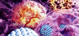 Ødelegger kreftceller med ultralyd og gassbobler