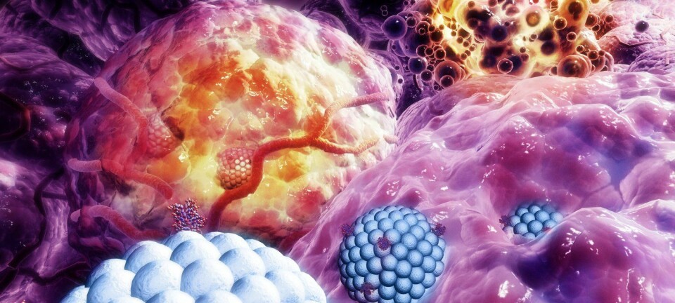 Illustrasjonen viser nanopartikler (blå) som ødelegger kreftcelle (lilla). De ødelagte cellene vises i orange.  (Illustrasjon: Science Photo Library/Scanpix)