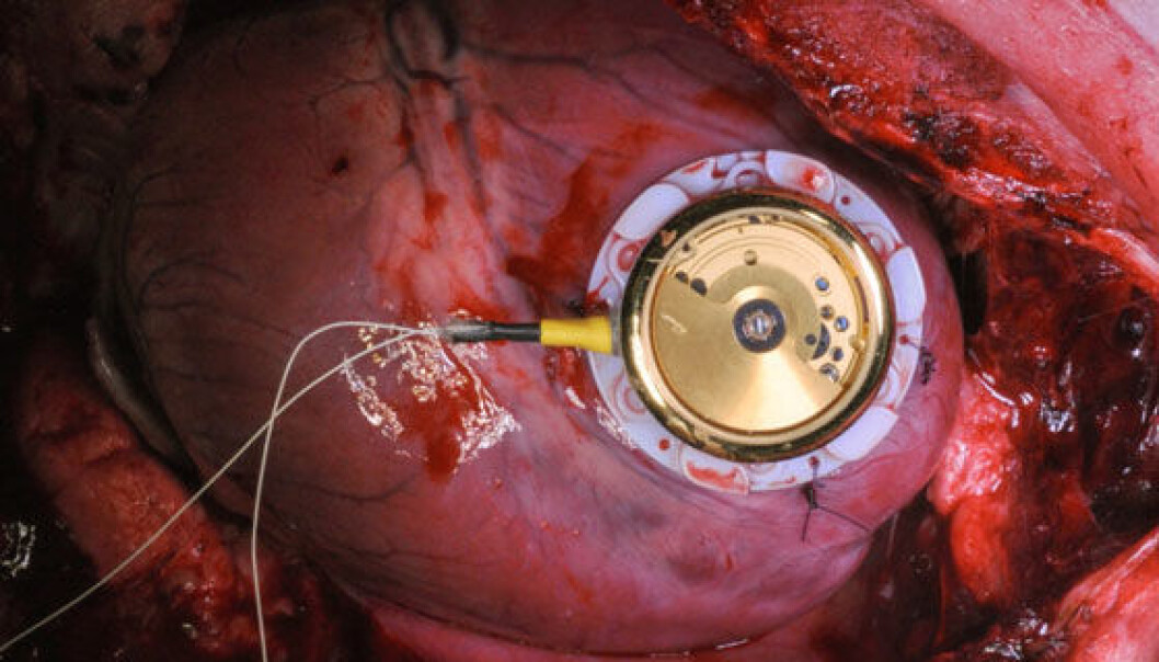 Her er komponentet som utnytter hjertets bevegelser for å lage energi, på samme måte som et armbåndsur. Her på et grisehjerte. (Foto: Escardio) Her er komponentet som utnytter hjertets bevegelser for å lage energi, på samme måte som et armbåndsur. Her på et grisehjerte. (Foto: Escardio)