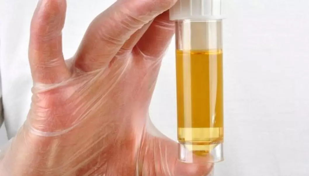 Usynlig blod i urinen kan avsløre blærekreft