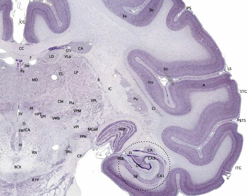 Hjernebarken (mørk fiolett på bildet) hos mennesker og andre pattedyr gir evne til oppmerksomhet, oppfatning, tanke, språk og bevissthet. Fisk har ikke hjernebark. (Foto: (Bilde: brainmaps.org, Creative Commons Attribution 3.0 License))