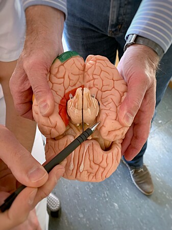 Her ligger hjerneområdet lateral entorhinal cortex - området som styrer med tidssansen og innholdet i minner. (Foto: Kavli Institute for Systems Neuroscience) Her ligger hjerneområdet lateral entorhinal cortex - området som styrer med tidssansen og innholdet i minner. (Foto: Kavli Institute for Systems Neuroscience)