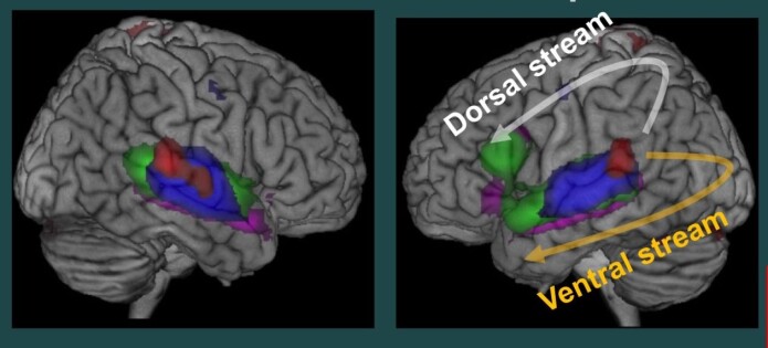 Language perception and brain networks (Photo: UiB) Language perception and brain networks (Photo: UiB)