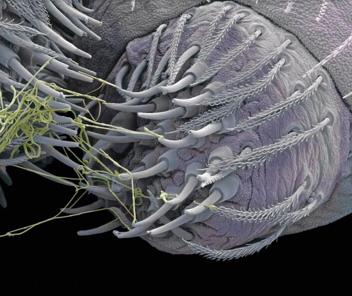 Spinnevorten til en edderkopp under et mikroskop. Trådene av silke kommer ut av små "munnstykker", og denne biologiske fabrikken spinner også trådene. (Foto: Science Photo Library/Scanpix) Spinnevorten til en edderkopp under et mikroskop. Trådene av silke kommer ut av små "munnstykker", og denne biologiske fabrikken spinner også trådene. (Foto: Science Photo Library/Scanpix)