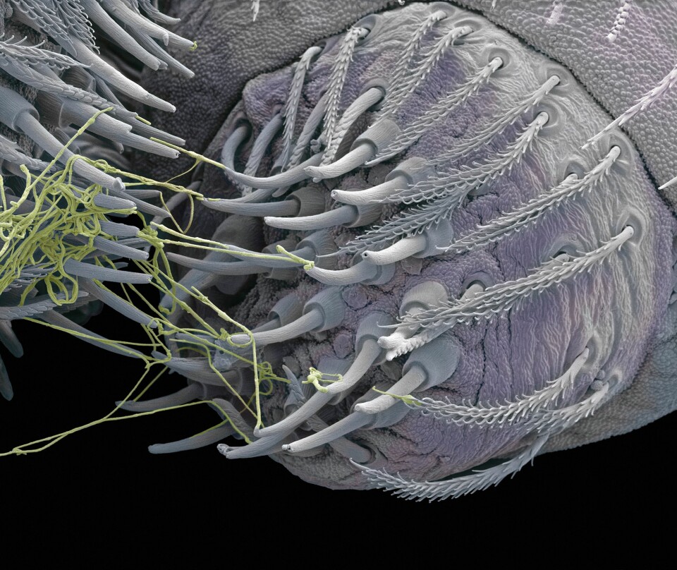 Spinnevorten til en edderkopp under et mikroskop. Trådene av silke kommer ut av små 'munnstykker', og denne biologiske fabrikken spinner også trådene. (Foto: Science Photo Library/Scanpix)
