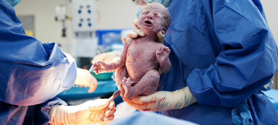 Den nye studien tar for seg nesten 170 000 førstegangsfødsler mellom 1999 og 2009. Microstock