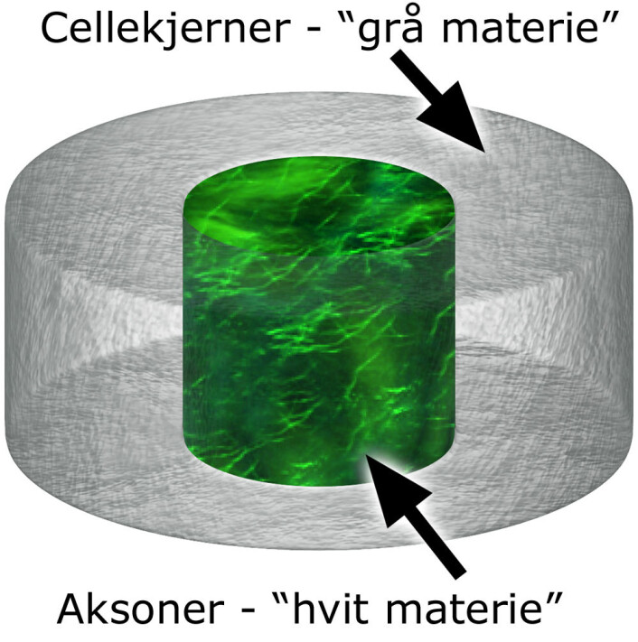 Figuren viser den porøse smultringen av silkeprotein (grå) med en gele av kollagen, proteinet i bindevev, i midten (grønn). Cellekjernene, den grå materien, vokste gjennom porene i smultringen, og aksonene, den hvite materien, vokste gjennom geleen og knyttet forbindelser mellom cellekjernene. (Foto: (Figur: National Institute of Biomedical Imaging and Bioengineering, bearbeidet av forskning.no)) Figuren viser den porøse smultringen av silkeprotein (grå) med en gele av kollagen, proteinet i bindevev, i midten (grønn). Cellekjernene, den grå materien, vokste gjennom porene i smultringen, og aksonene, den hvite materien, vokste gjennom geleen og knyttet forbindelser mellom cellekjernene. (Foto: (Figur: National Institute of Biomedical Imaging and Bioengineering, bearbeidet av forskning.no))