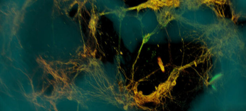 Mikroskopi av hjerneceller (grønngule) festet til et rammeverk av porøs silke (blå). Hjernecellene dannet funksjonelle nettverk gjennom porene i rammeverket (mørke områder). Tufts University