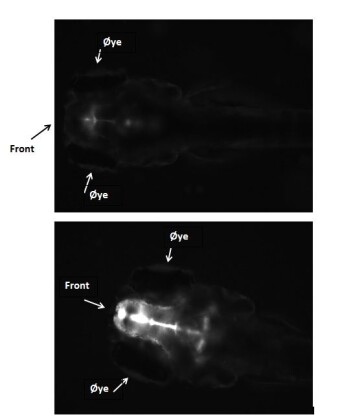 Svarthvitt bilde av hodet til sebrafiskembryo fem dager etter fertilisering. Embryoet øverst er ikke eksponert og har lite GFP i hjernen (hvit farge). Embryoet nederst er eksponert for østrogen og har høyt nivå av GFP i hjernen. (Foto: UFZ, Karina Petersen) Svarthvitt bilde av hodet til sebrafiskembryo fem dager etter fertilisering. Embryoet øverst er ikke eksponert og har lite GFP i hjernen (hvit farge). Embryoet nederst er eksponert for østrogen og har høyt nivå av GFP i hjernen. (Foto: UFZ, Karina Petersen)